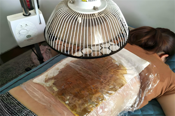 中药敷包减肥加盟