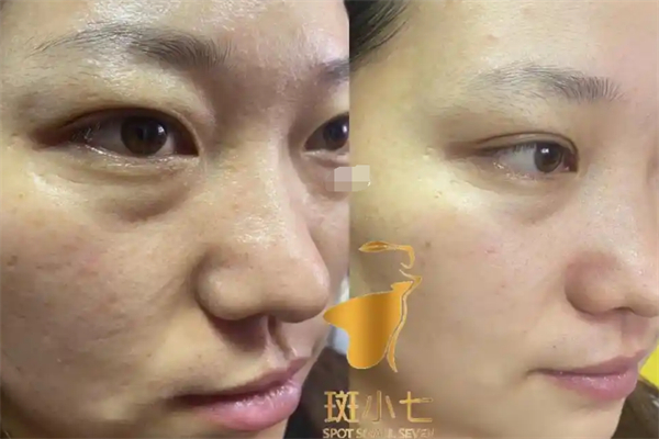 斑小七