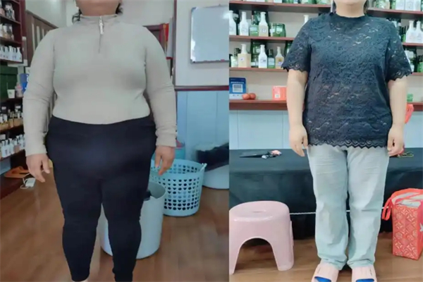 美丽瘦吧