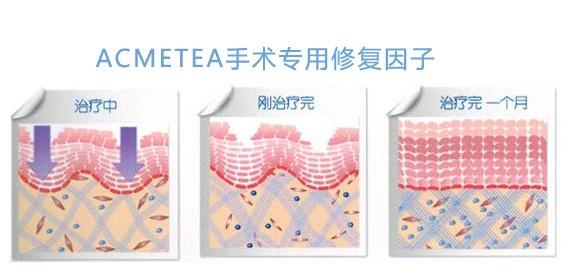 艾苛蜜spa