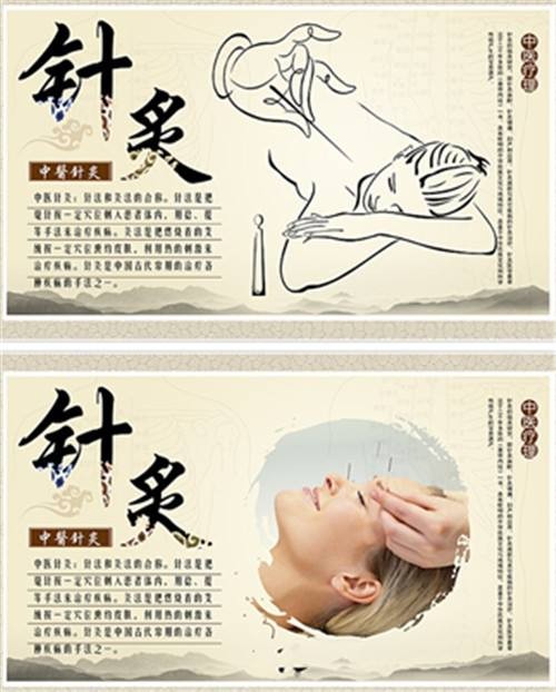 惠安针灸推拿